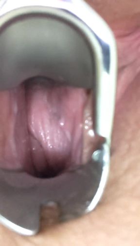 My Speculum Opens Me up - HD - 1:20 video - featuring Rebecca Vanguard - from FapHouse