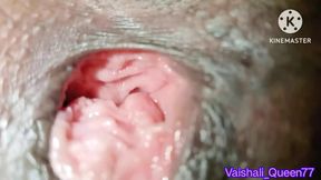 Desi Indian bhabhi's chut was torn and kept deep hole chut - HD - 8:36 video - from xHamster