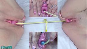 Prolapsed Cervix Lesbians at the same time - HD - 2:01 video - from XVideos