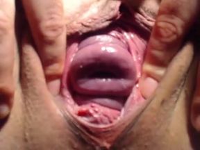 Longest cervix show ever - HD - 8:12 video - from xHamster