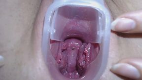 Teenage showing her Cervix with deep and close-up exploration - HD - 9:43 video - from XGroovy