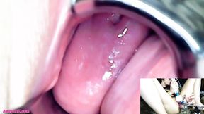 AdalynnX - Endoscope Speculum Hitachi Vibrator Cum - HD - 13:28 video - from xHamster