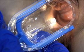 Comp Speculum Edit! Anal &amp; Pussy Speculum Close Ups! - HD - 12:55 video - from xHamster