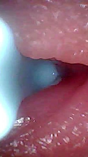 Unforgettable moment from "I couldn't believe what happens INSIDE the penis as sperm passes through (endoscopic footage)" - HD - 0:30 video - from xHamster
