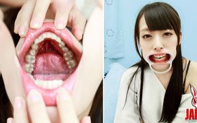 Ikumi Kuroki's Vulnerable Revelation: a Journey Into Dental Sensitivities and Unveiled Imperfections - HD - 14:37 video - from xHamster