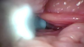 Semen in Cervix Wide Stretching Pussy Endoscope! - HD - 15:48 video - from xHamster