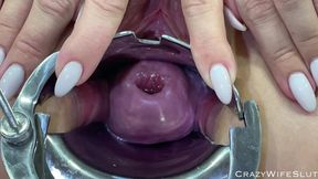 Glass Dildo Cervix Penetration - HD - 10:20 video - from FapHouse